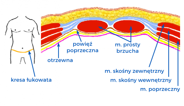 pubalgia sportowcow kresa lukowata